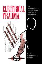 Electrical Trauma