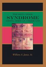 The Skin Color Syndrome Among African-Americans