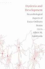 Dyslexia & Development – Neurobiological Aspects of Extra–Ordinary Brains