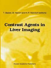 Contrast Agents in Liver Imaging