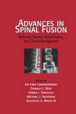 Advances in Spinal Fusion: Molecular Science, BioMechanics, and Clinical Management