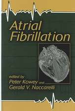 Atrial Fibrillation