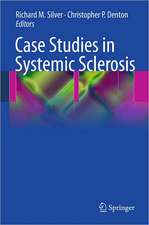 Case Studies in Systemic Sclerosis