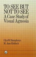 To See But Not To See: A Case Study Of Visual Agnosia