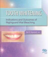 Tooth Whitening