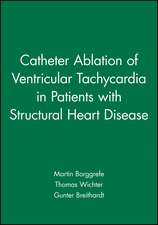 Catheter Ablation of Ventricular Tachycardia in Patients with Structural Heart Disease