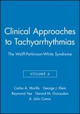 The Wolff–Parkinson–White Syndrome