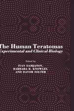 The Human Teratomas: Experimental and Clinical Biology