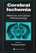 Cerebral Ischemia: Molecular and Cellular Pathophysiology