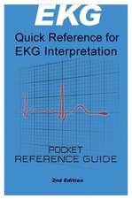 EKG Pocket Guide