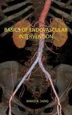 Basics of Endovascular Intervention