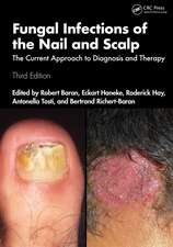 Fungal Infections of the Nail and Scalp: The Current Approach to Diagnosis and Therapy