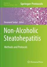 Non-Alcoholic Steatohepatitis: Methods and Protocols