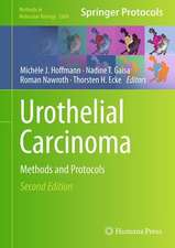 Urothelial Carcinoma: Methods and Protocols