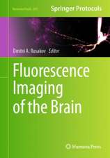 Fluorescence Imaging of the Brain