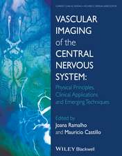 Vascular Imaging of the Central Nervous System – Physical Principles, Clinical Applications, and Emergency Techniques