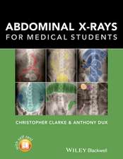 Abdominal X–rays for Medical Students