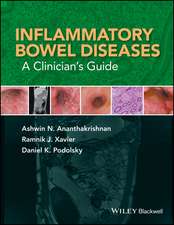 Inflammatory Bowel Diseases – A Clinician′s Guide