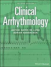 Clinical Arrhythmology, 2nd Edition