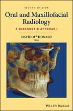 Oral and Maxillofacial Radiology – A Diagnostic Approach, 2nd Edition