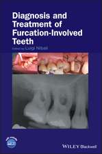 Diagnosis and Treatment of Furcation–Involved Teeth