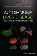 Autoimmune Liver Disease – Management and Clinical Practice