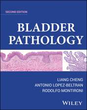 Bladder Pathology