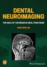 Dental Neuroimaging – The Role of the Brain in Oral Functions