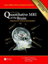 Quantitative MRI of the Brain: Principles of Physical Measurement, Second edition