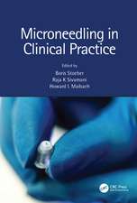 Microneedling in Clinical Practice