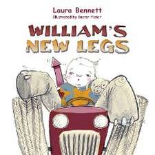 William's New Legs