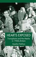 Hearts Exposed: Transplants and the Media in 1960s Britain