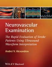 Neurovascular Examination – The Rapid Evaluation of Stroke Patients Using Ultrasound Waveform Interpretation