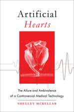 Artificial Hearts – The Allure and Ambivalence of a Controversial Medical Technology