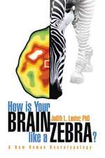 How Is Your Brain Like a Zebra?