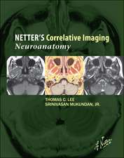 Netter's Correlative Imaging: Neuroanatomy: with NetterReference.com Access