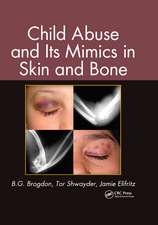 Child Abuse and Its Mimics in Skin and Bone