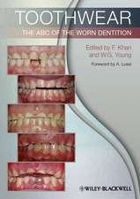 Toothwear – The ABC of the Worn Dentition