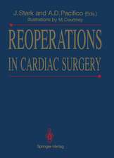 Reoperations in Cardiac Surgery