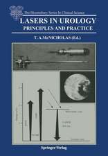 Lasers in Urology: Principles and Practice