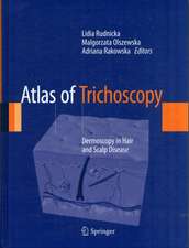 Atlas of Trichoscopy: Dermoscopy in Hair and Scalp Disease