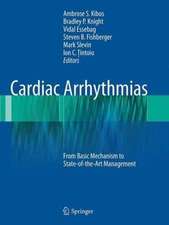 Cardiac Arrhythmias: From Basic Mechanism to State-of-the-Art Management