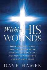 Within His Wounds