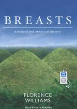 Breasts: A Natural and Unnatural History