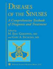 Diseases of the Sinuses: A Comprehensive Textbook of Diagnosis and Treatment