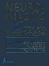 Neuroimaging: Clinical and Physical Principles