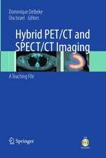 Hybrid PET/CT and SPECT/CT Imaging: A Teaching File