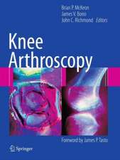 Knee Arthroscopy