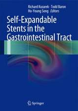 Self-Expandable Stents in the Gastrointestinal Tract