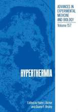 Hyperthermia